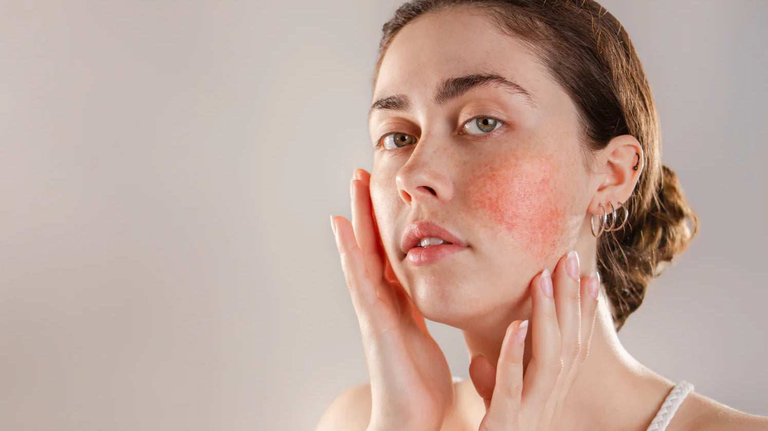 Femme avec des rougeurs sur les joues touchant délicatement son visage, illustrant les soins adaptés pour les peaux sensibles et réactives