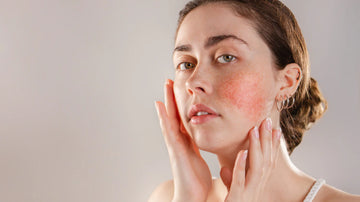 Femme avec des rougeurs sur les joues touchant délicatement son visage, illustrant les soins adaptés pour les peaux sensibles et réactives