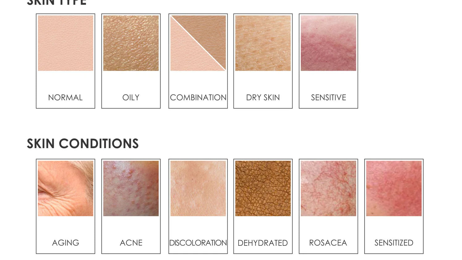 Comment Reconnaître Votre Type de Peau ?
